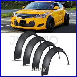 For Hyundai Veloster Flexible Fender Flares Wheel Arch Extra Wide Body Kit 4.5